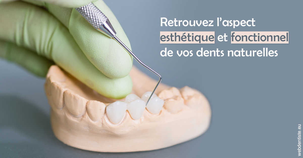 https://dr-wintenberger-hugo.chirurgiens-dentistes.fr/Restaurations dentaires 1
