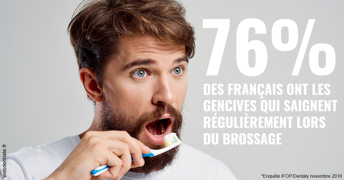 https://dr-wintenberger-hugo.chirurgiens-dentistes.fr/76% des Français 2