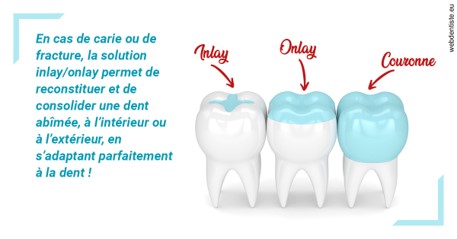 https://dr-wintenberger-hugo.chirurgiens-dentistes.fr/L'INLAY ou l'ONLAY