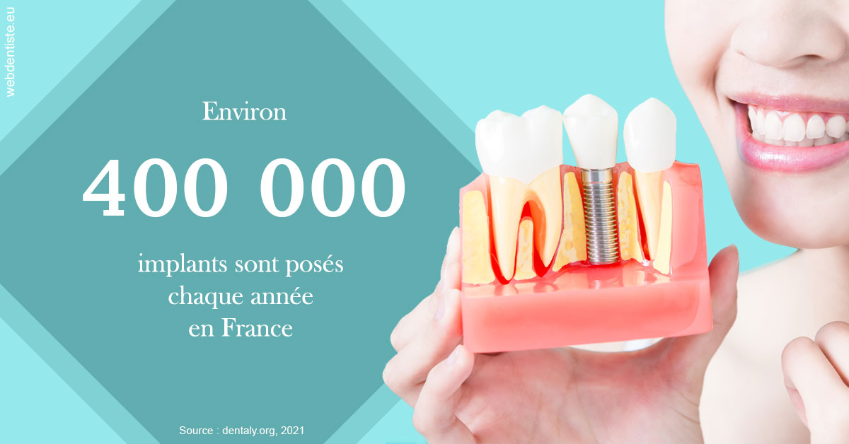 https://dr-wintenberger-hugo.chirurgiens-dentistes.fr/Pose d'implants en France 2